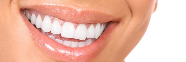 blanquear los dientes