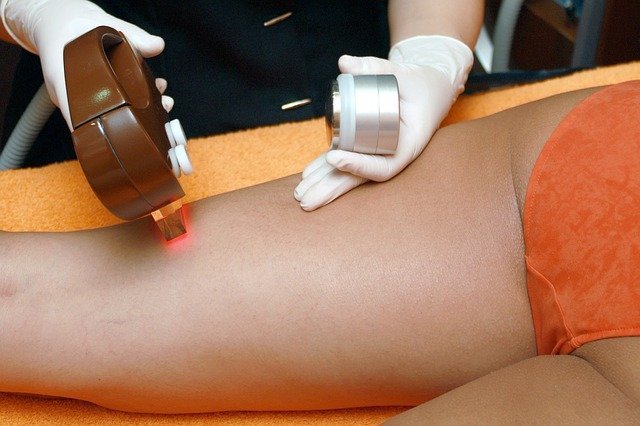 depilacion-laser depilacion-laser